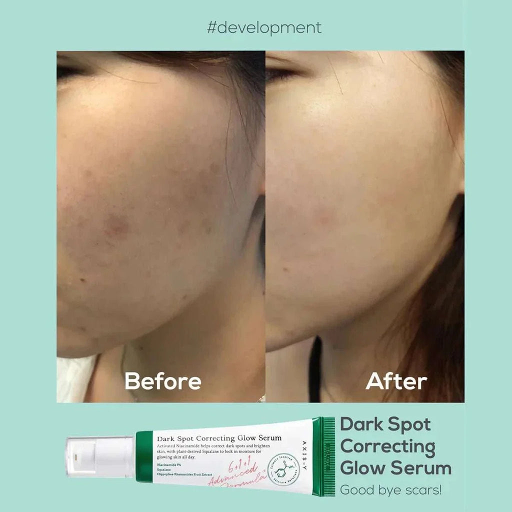 Axis-Y Dark Spot Glow Serum 50ml – full packaging